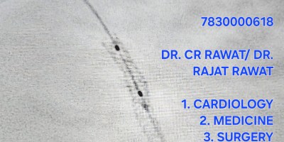 Best Angioplasty Doctors in Agra