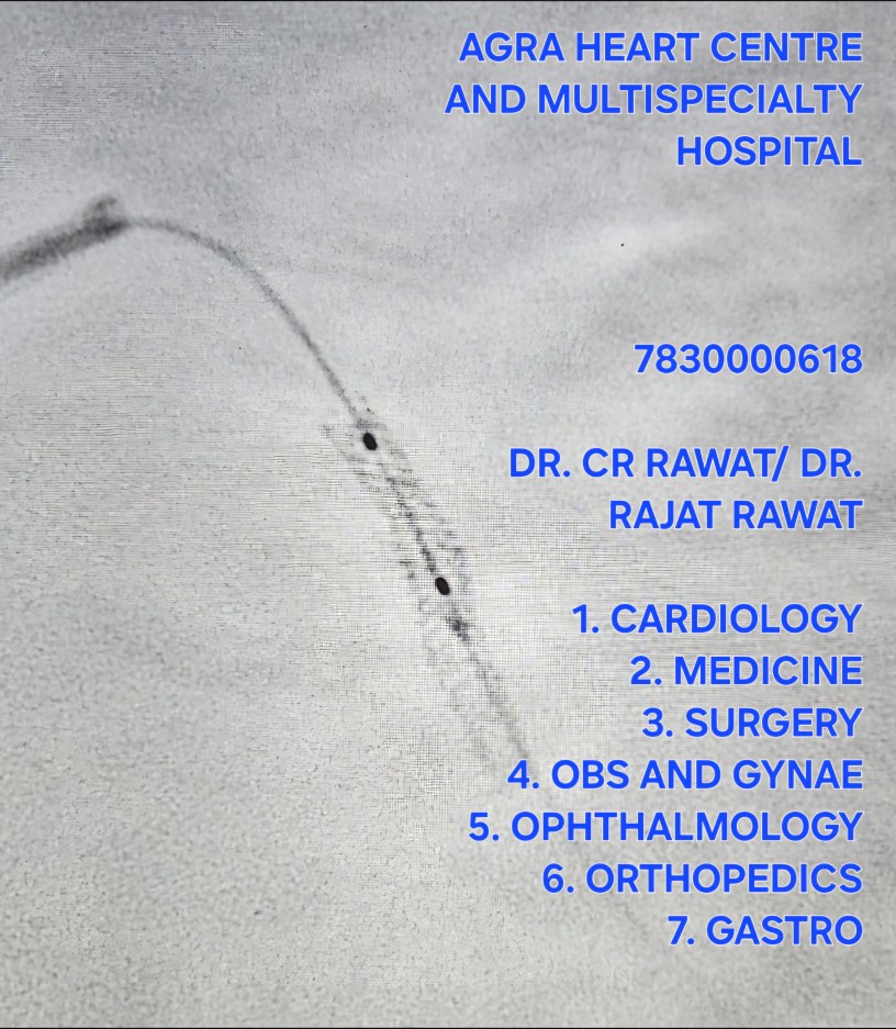 Best Angioplasty Doctors in Agra